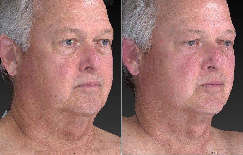 Side-by-side close-up portraits of the same man against a dark background, one brighter than the other