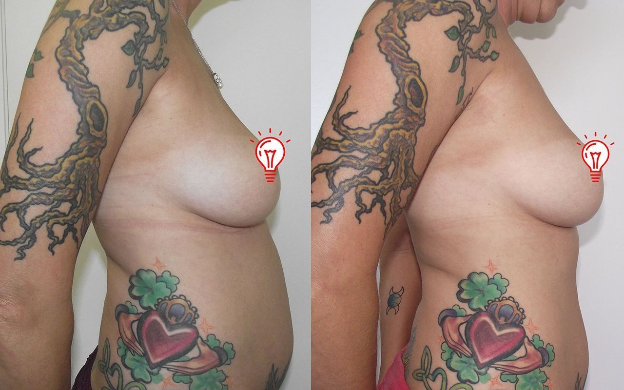 Side-by-side torso photos showing a tattooed side profile with a heart-and-clover lower back tattoo.