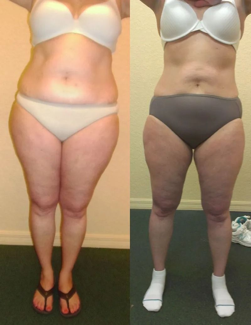 Side-by-side body transformation photo of a woman in underwear, before and after weight loss.