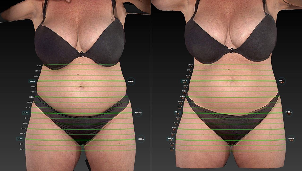 Side-by-side comparison of a woman in black underwear with horizontal measurement lines over her torso and hips.