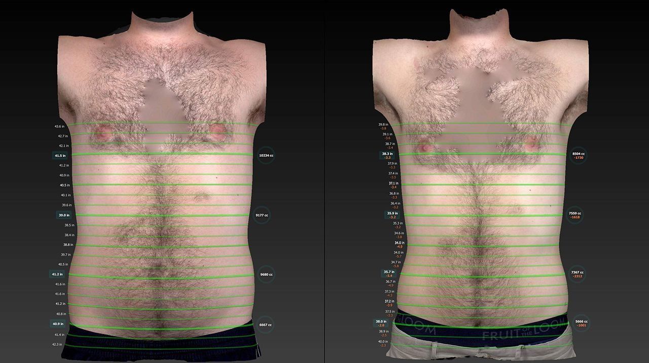 Side-by-side torso photos of a chest and abdomen with horizontal measurement lines overlaid