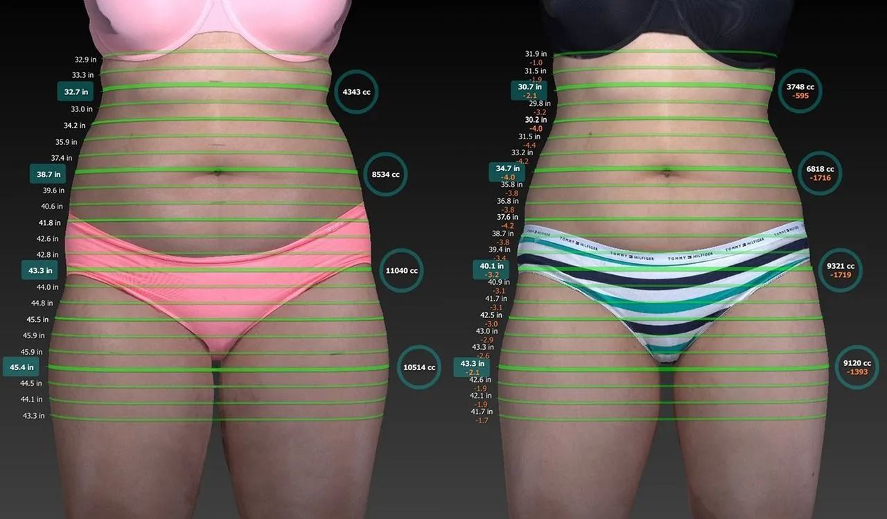 Side-by-side before-and-after torso photos showing waist and hip measurements with colored guide lines