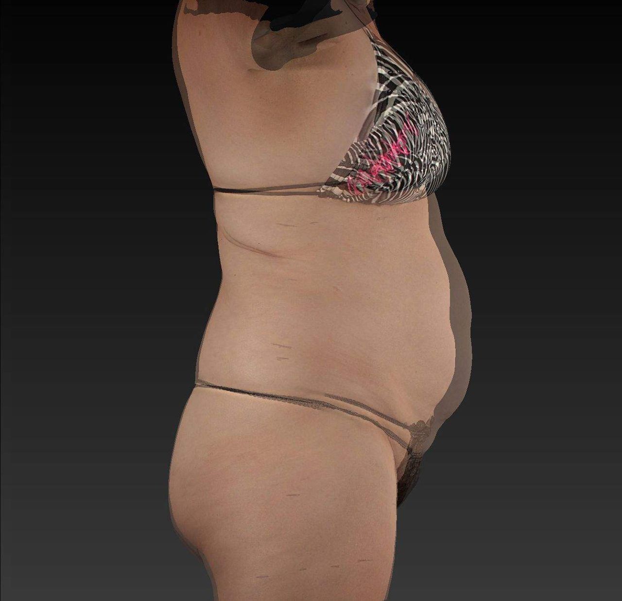Side-view person in patterned bikini, standing against a black background