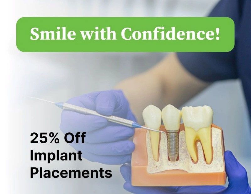 Dental implant promo with gloved hand holding model teeth, text: “Smile with Confidence! 25% Off Implant Placements”