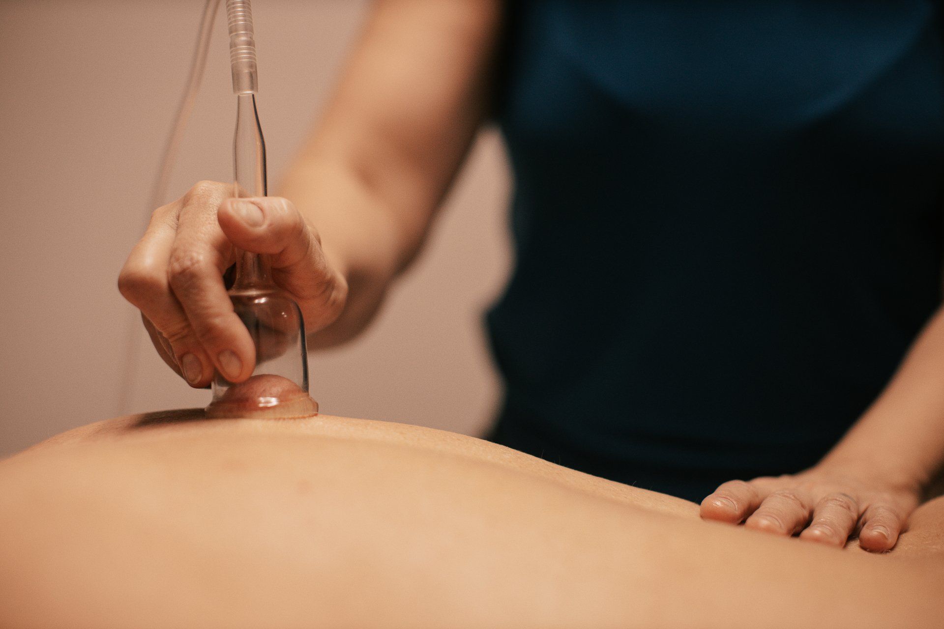 MediCupping Treatment