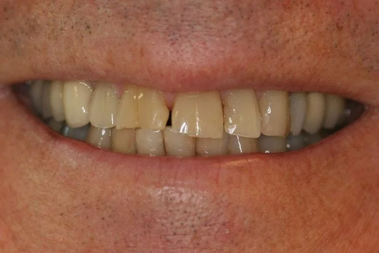 Before dental transformations