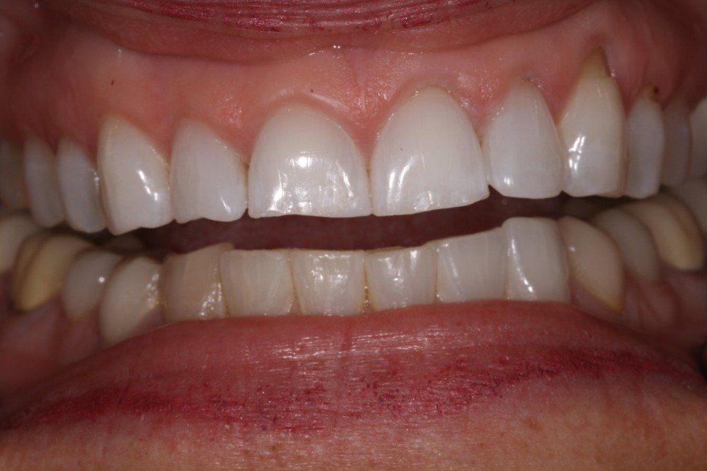 Dental