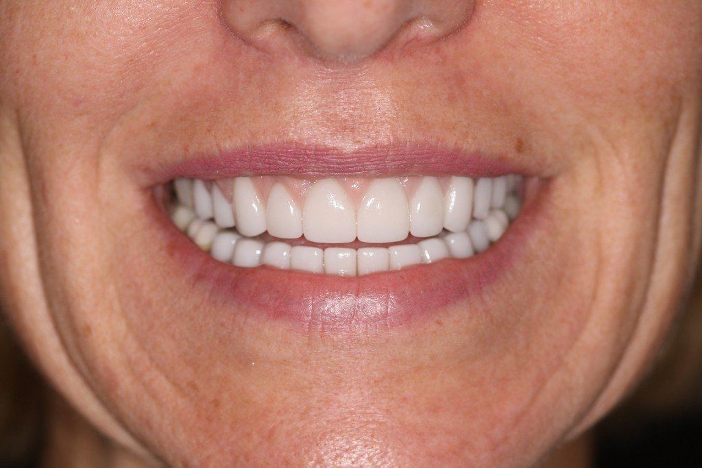 Dental