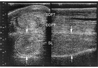 diagnostic ultrasound of tissue