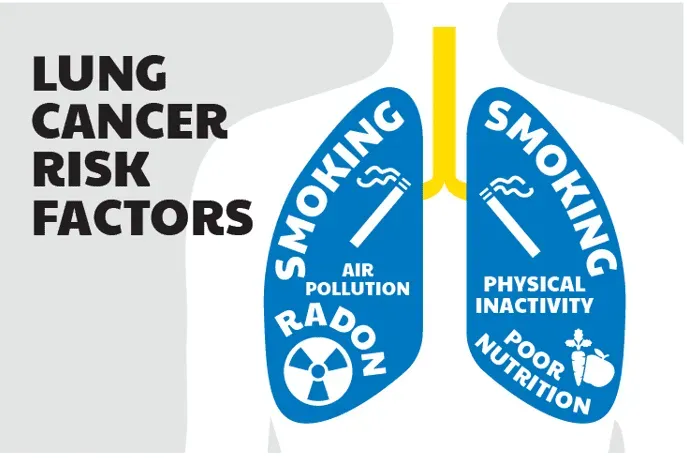 Infographic of lung cancer risk factors, showing smoking, air pollution, radon, physical inactivity, and poor nutrition in blue lungs.