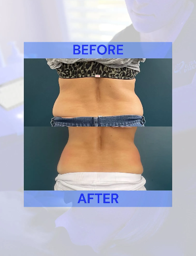 Side-by-side comparison of a person's back; 