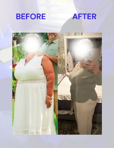 Weight loss comparison: Woman in a white dress before, woman in green shirt and pants after.