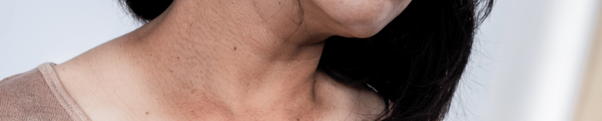 Close-up of a person's neck and chest, with dark hair and a light-colored top. The skin shows some texture and color variation.