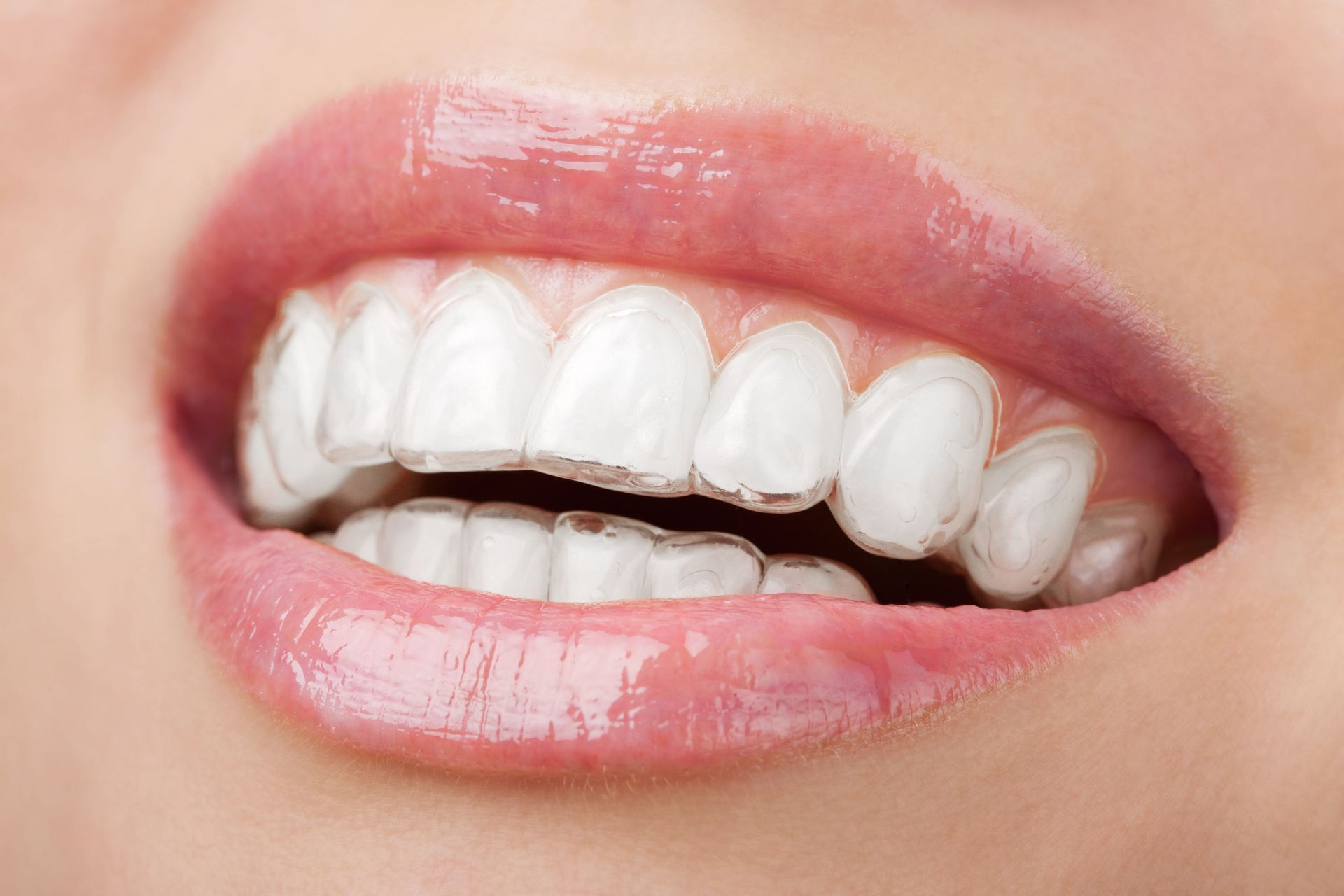 Close-up of a smiling mouth with white teeth and glossy pink lips