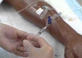 Intravenous-Therapy-PICC-line-dressing-changes