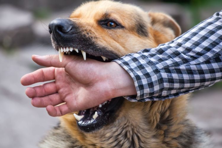 Dog Bites and Attacks