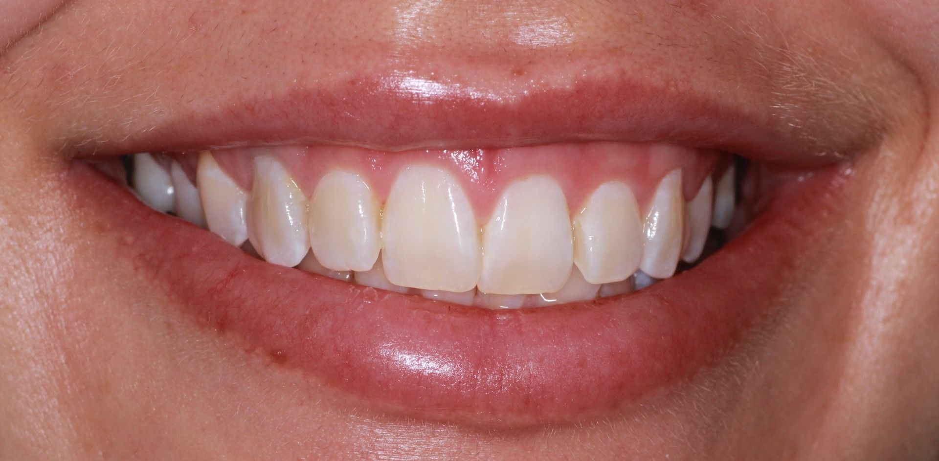 A before image of a dental service