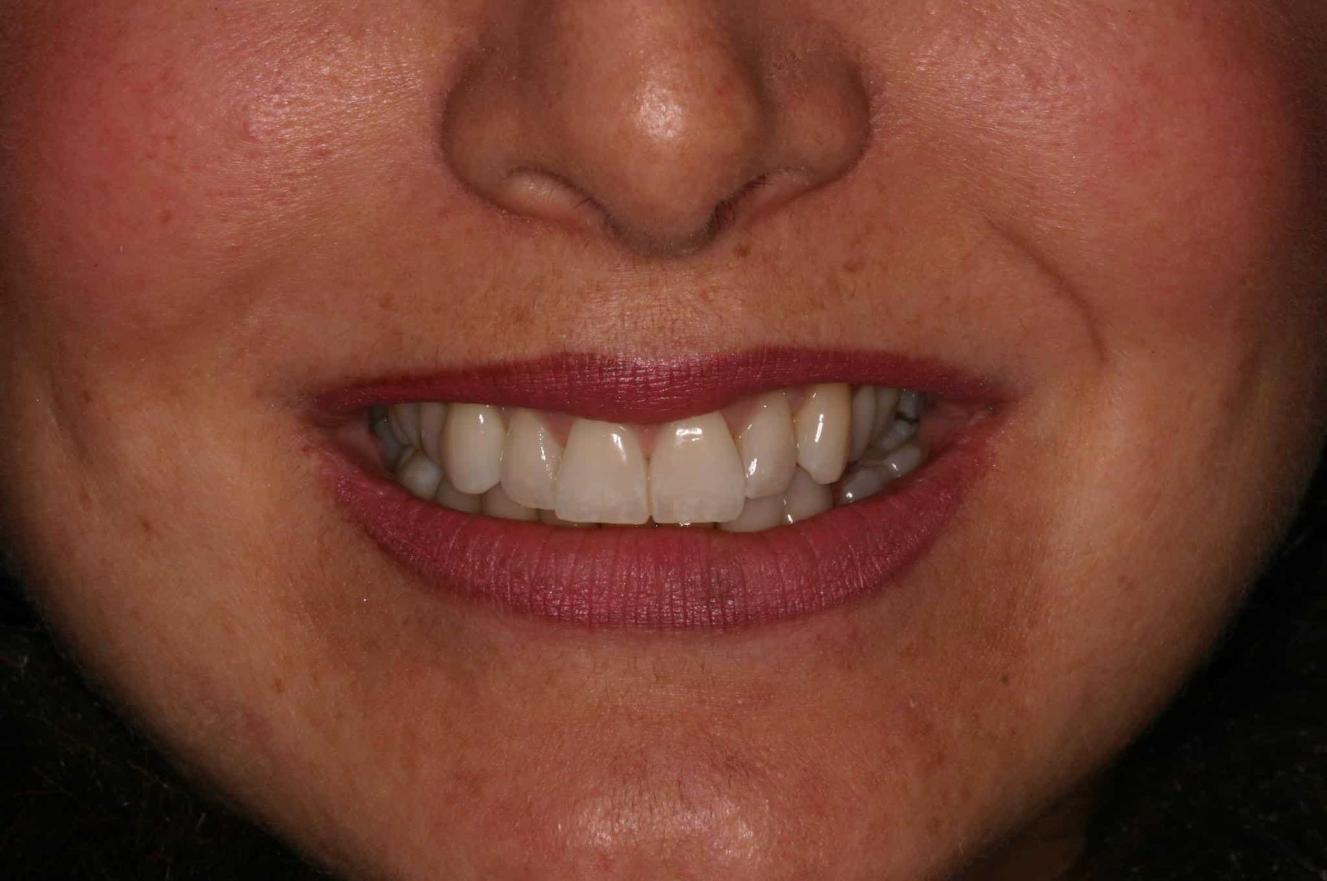 A close up of a woman 's mouth with white teeth and red lipstick.