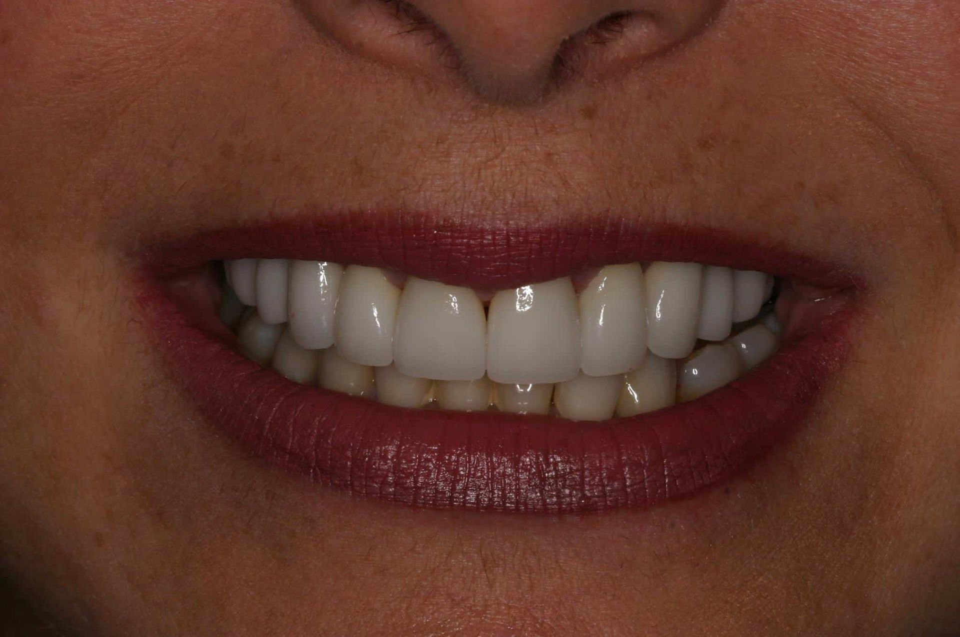 A close up of a woman 's smile with white teeth and red lipstick.