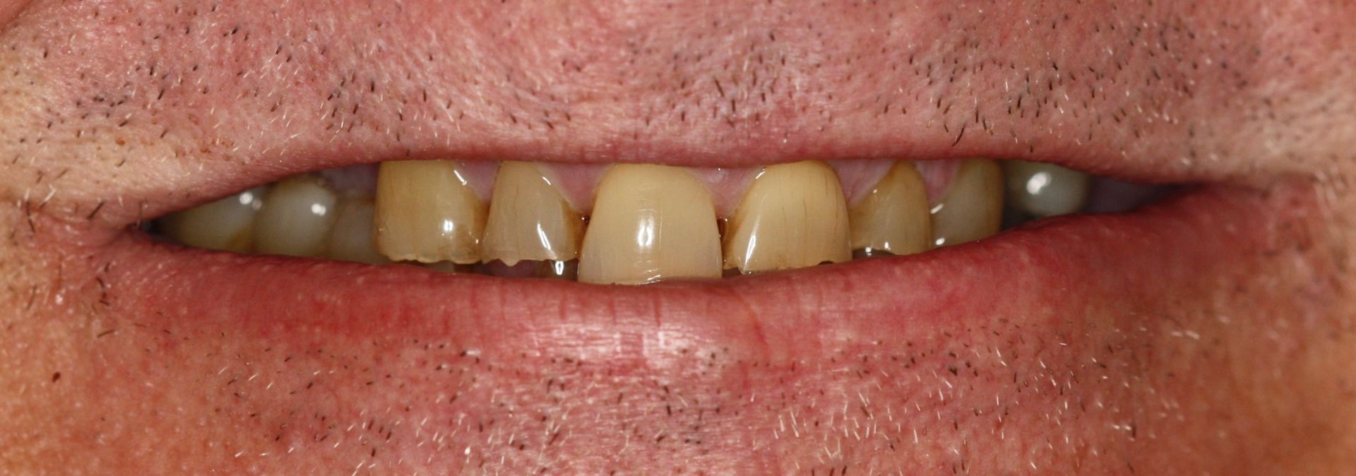 A before image of a dental service