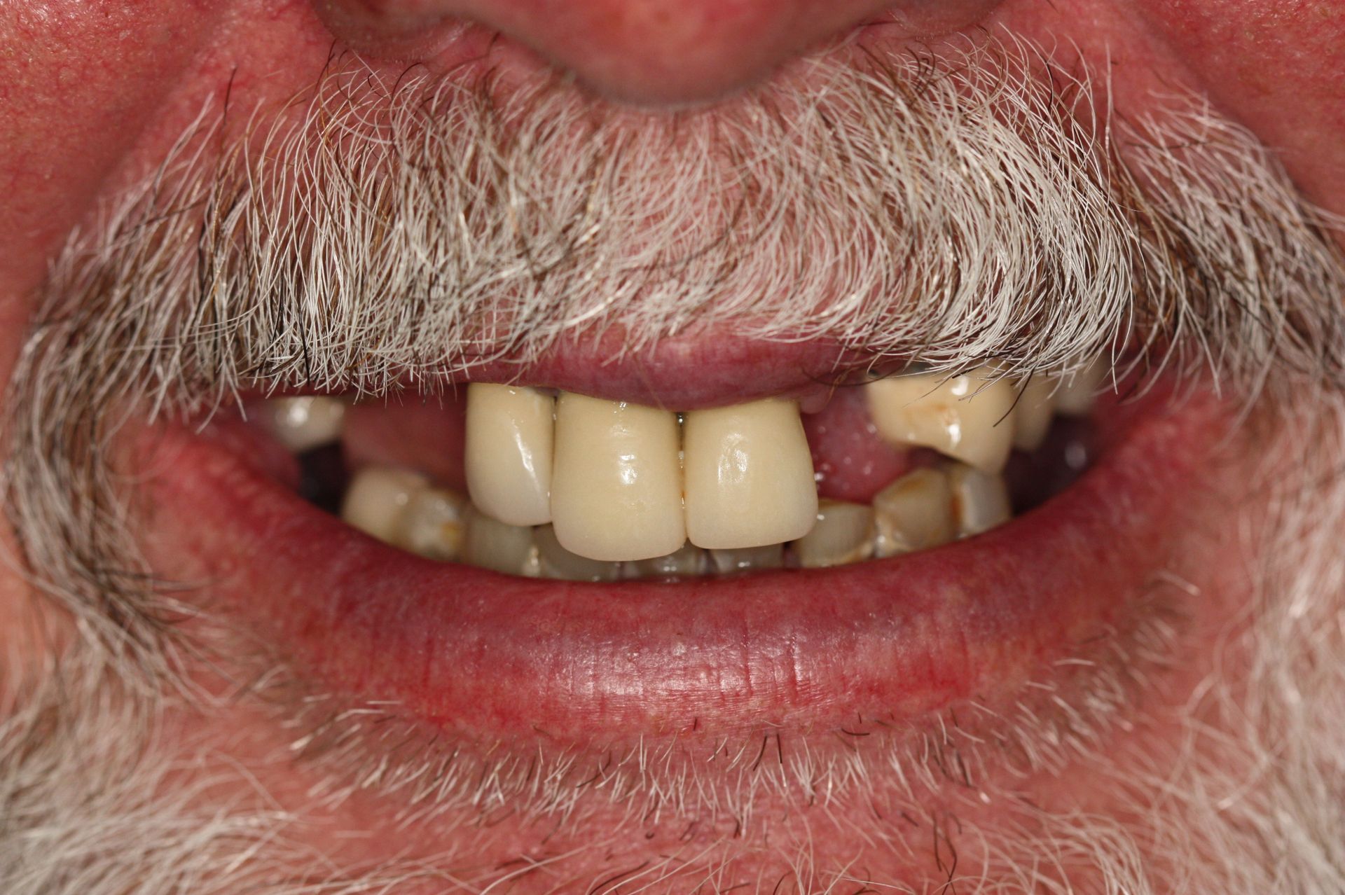 A before image of a dental service