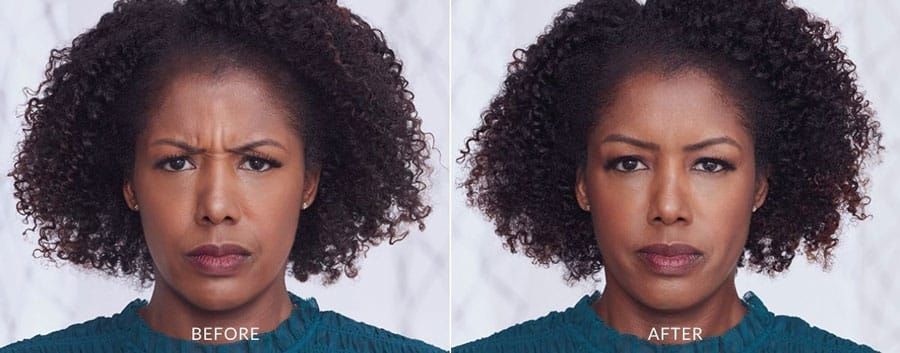 A before and after photo of a woman with curly hair
