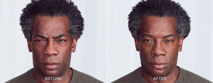 A before and after photo of a man 's face.