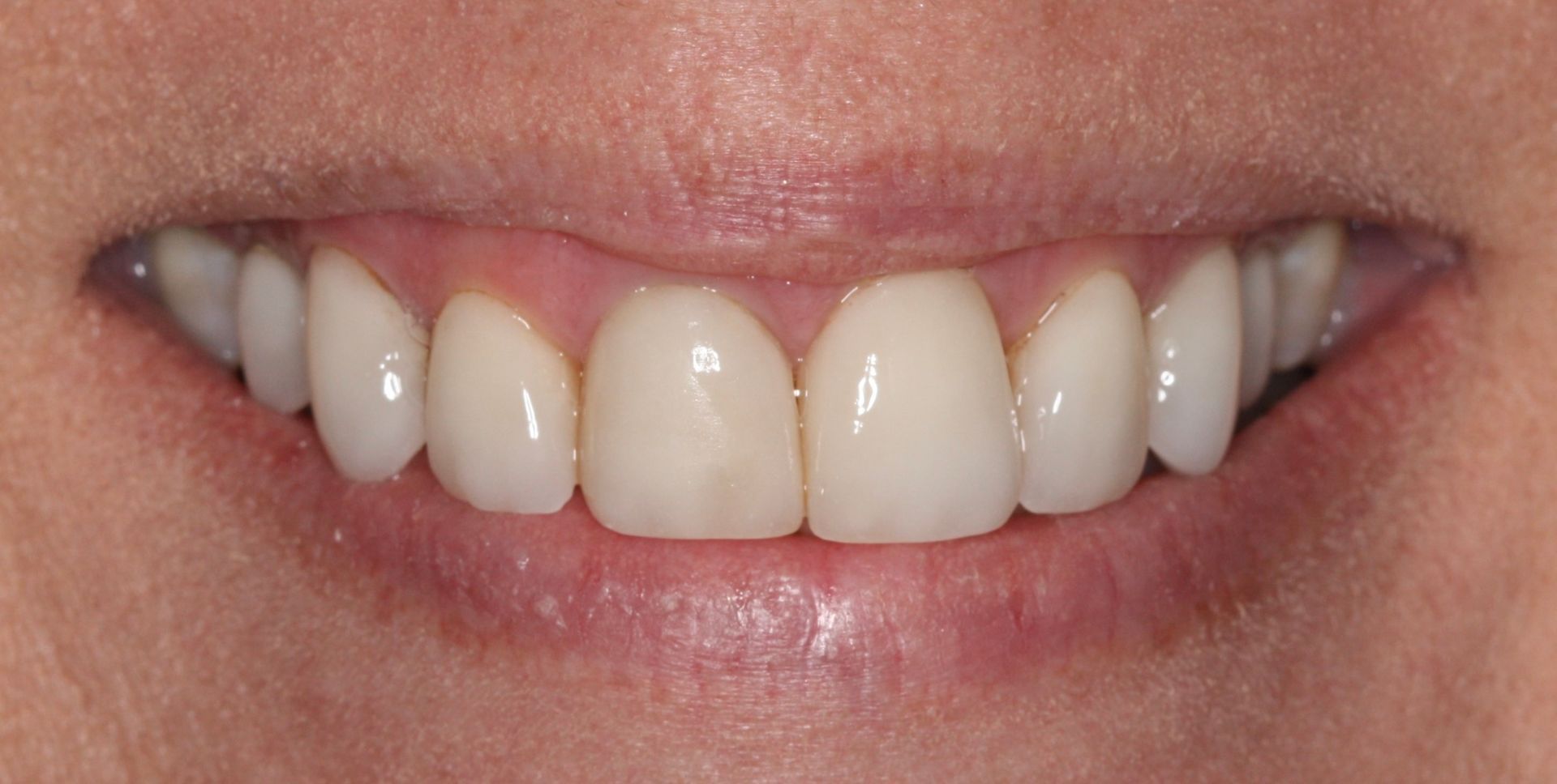 A before image of a dental service