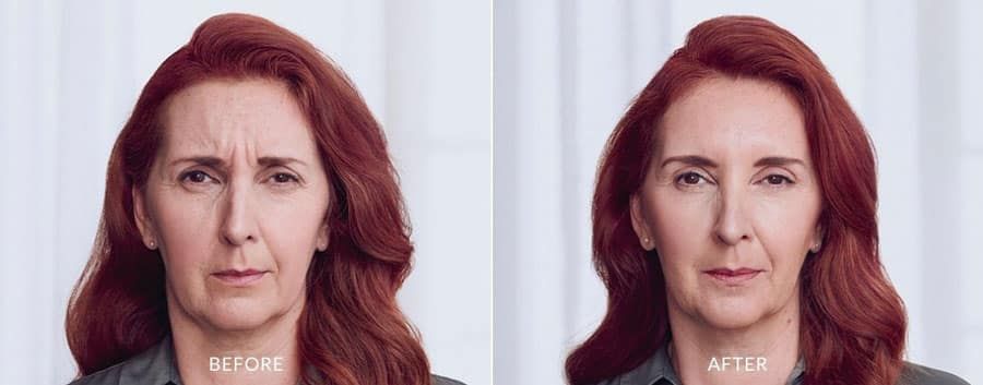 A before and after photo of a woman with red hair.