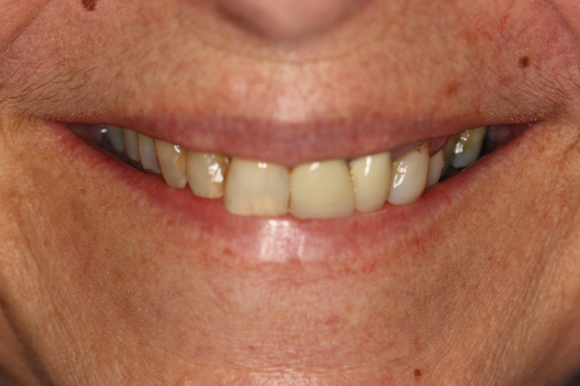 A before image of a dental service