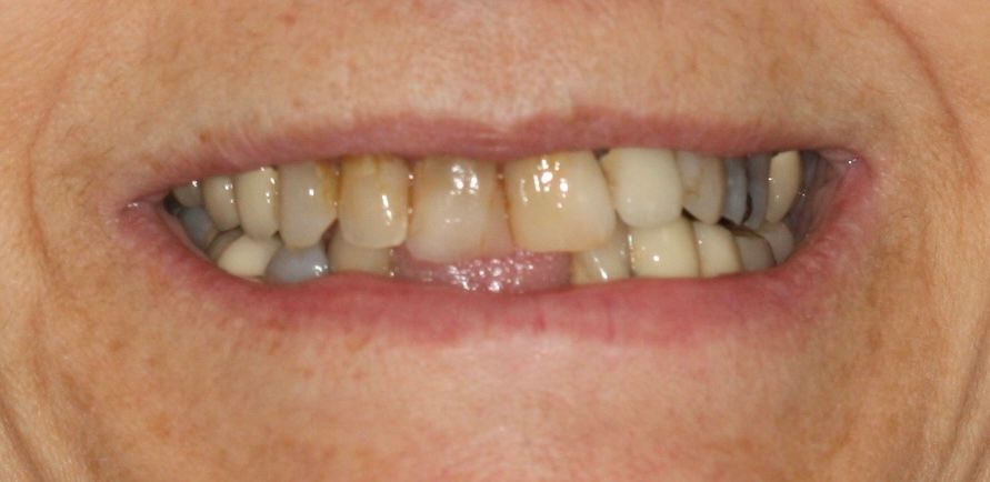 A before image of a dental service