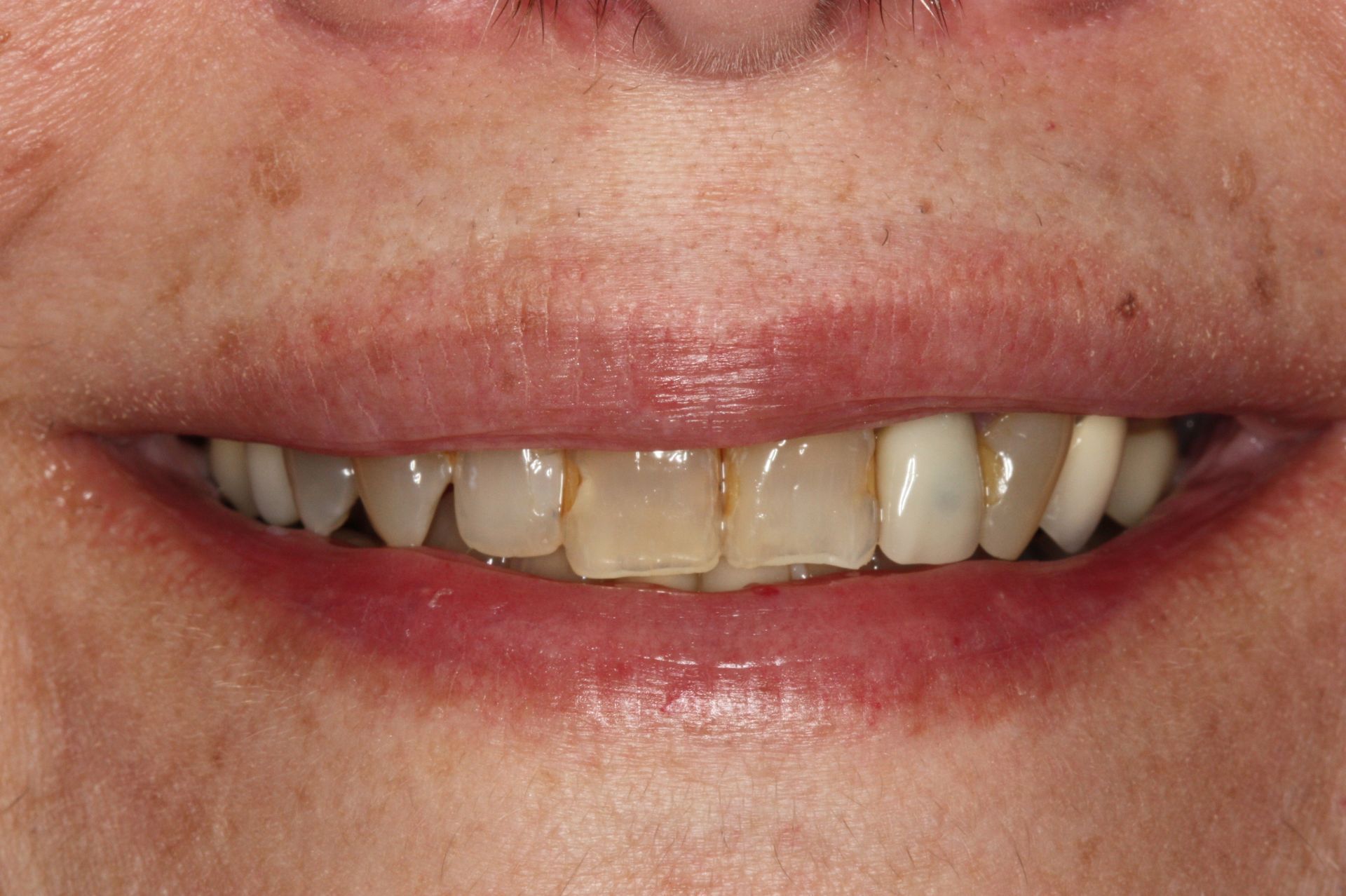 A before image of a dental service