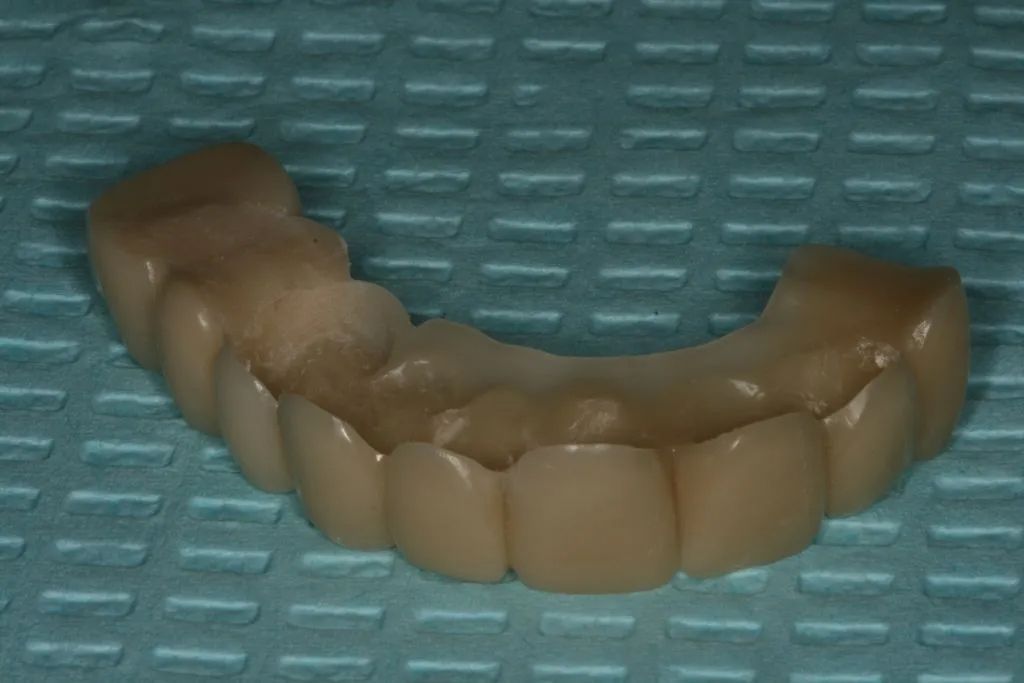 A denture is sitting on top of a blue towel on a table.
