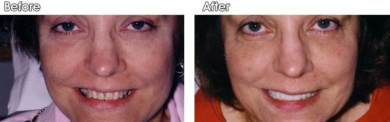 A before and after photo of a woman's face.