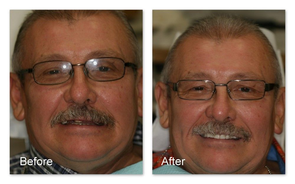 A before and after photo of a man with glasses and a mustache.