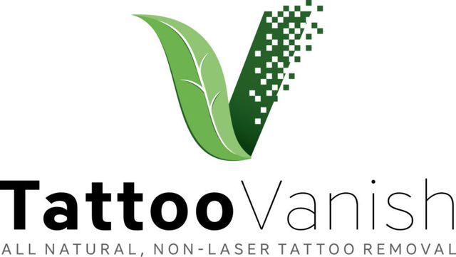 Vanish Tattoo Removal  Home  Facebook