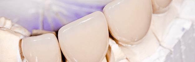Teeth Cap