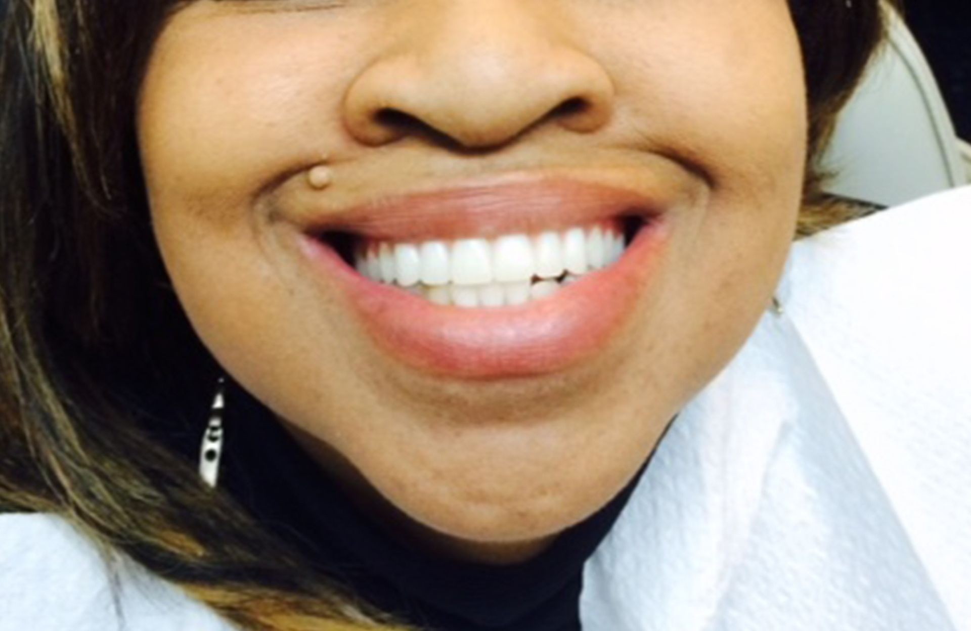 Close-up of a smiling mouth with white teeth and a nose piercing, wearing a white shirt