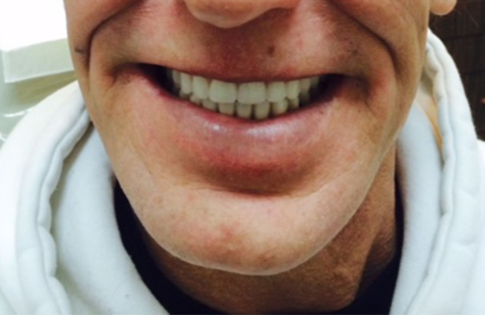 Close-up of a smiling mouth and chin, wearing a white hoodie.