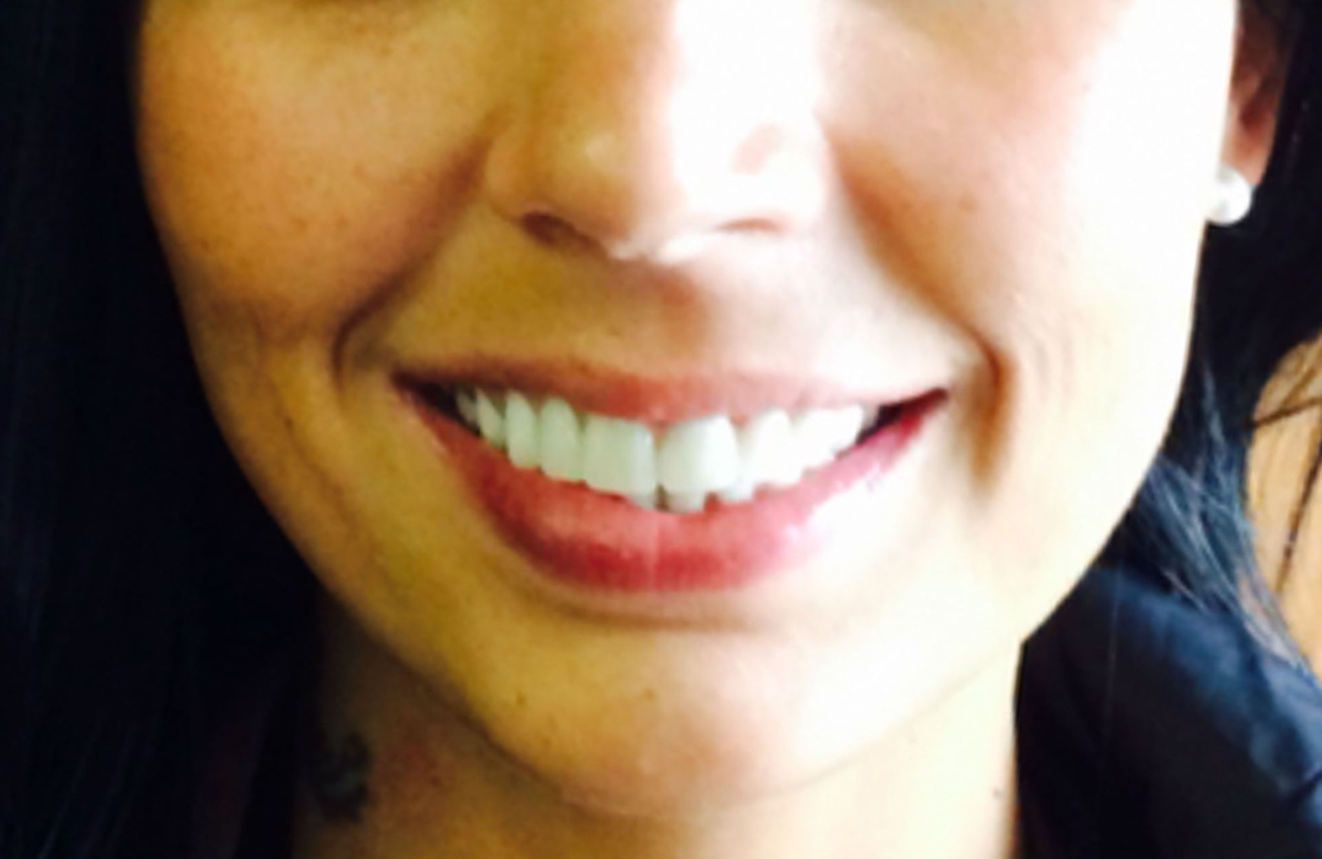 Close-up of a smiling mouth and lower face with white teeth and red lipstick
