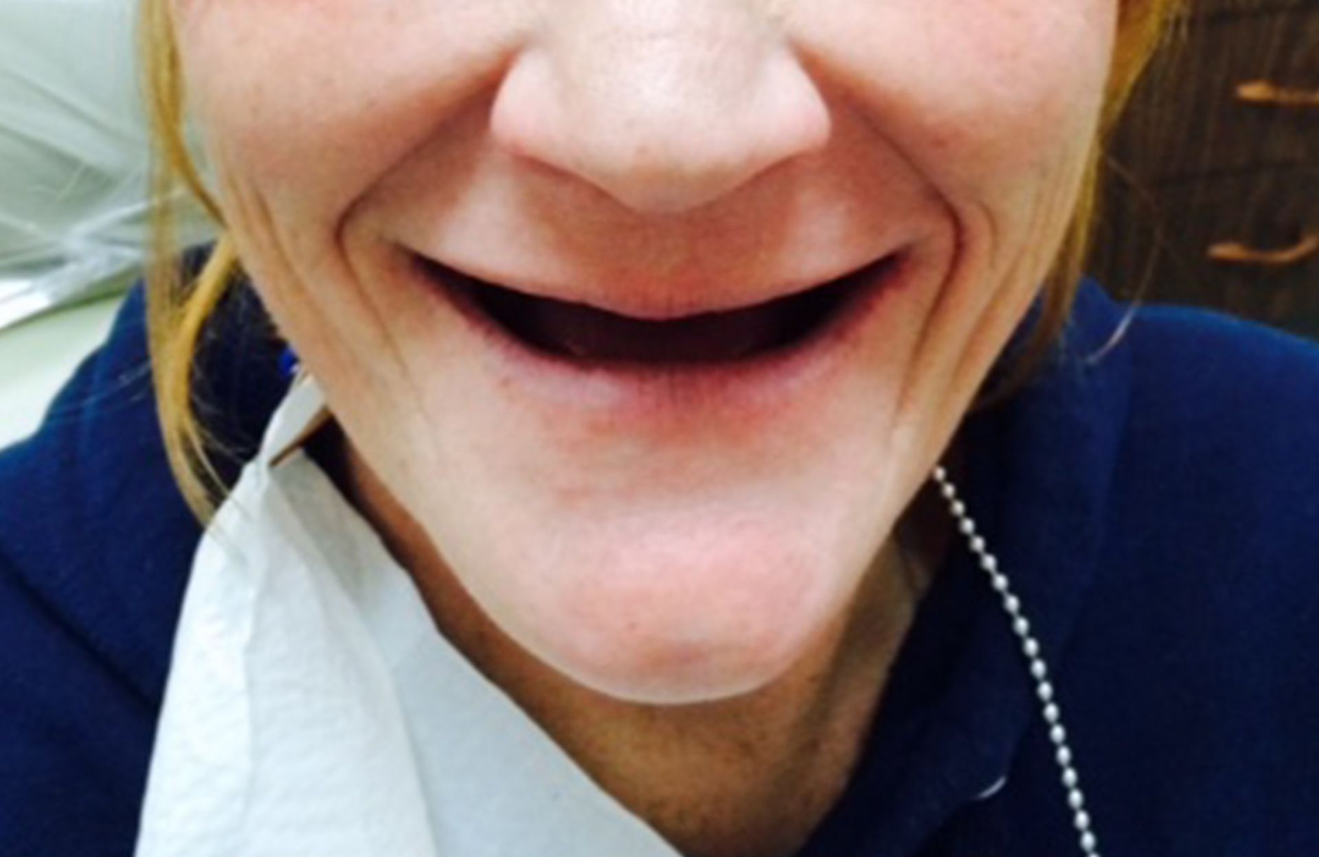 Close-up of a smiling person’s mouth and chin, wearing a blue jacket and white shirt.