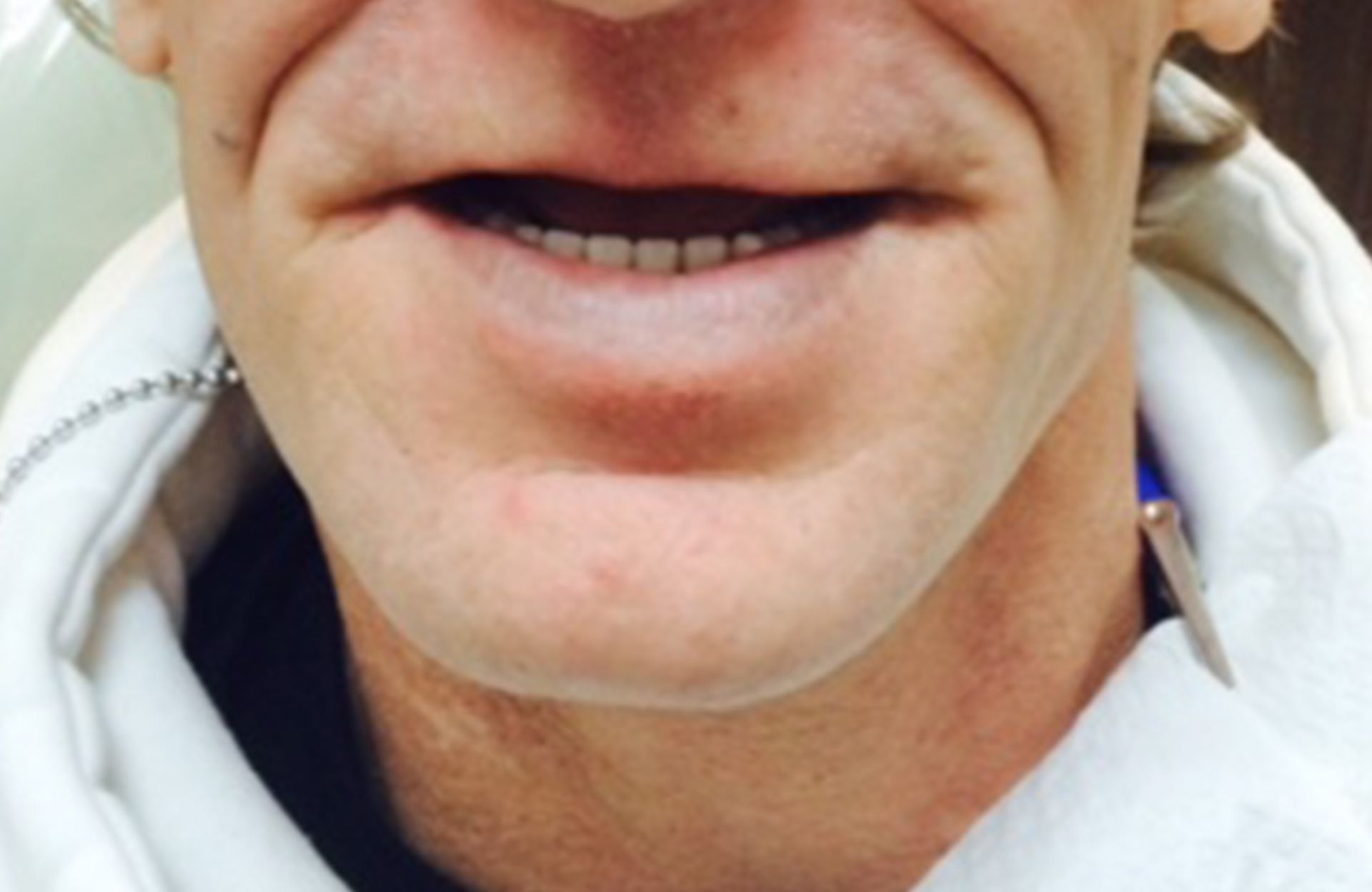 Close-up of a smiling mouth and chin in a white hoodie