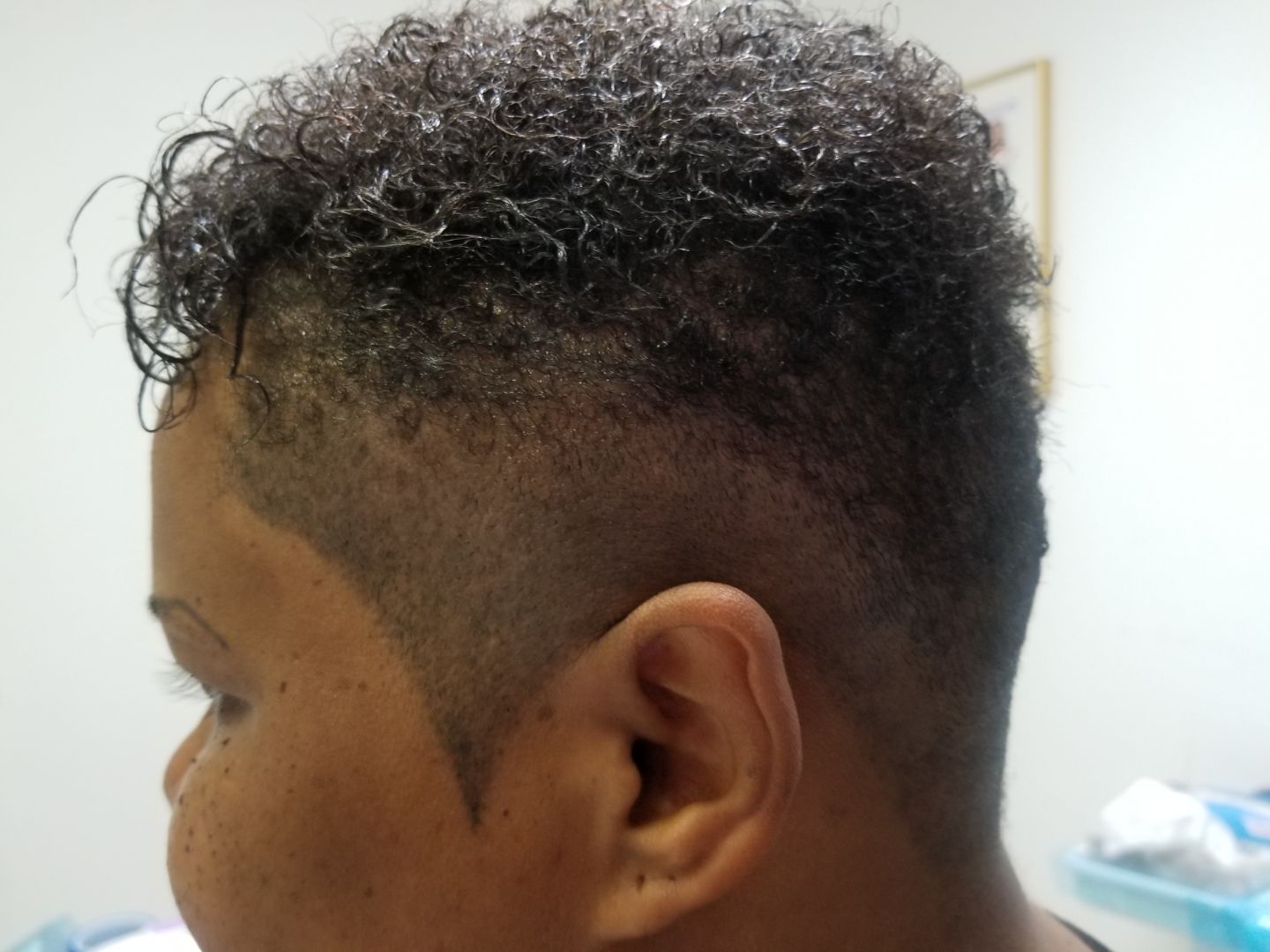 scalp micropigmentation