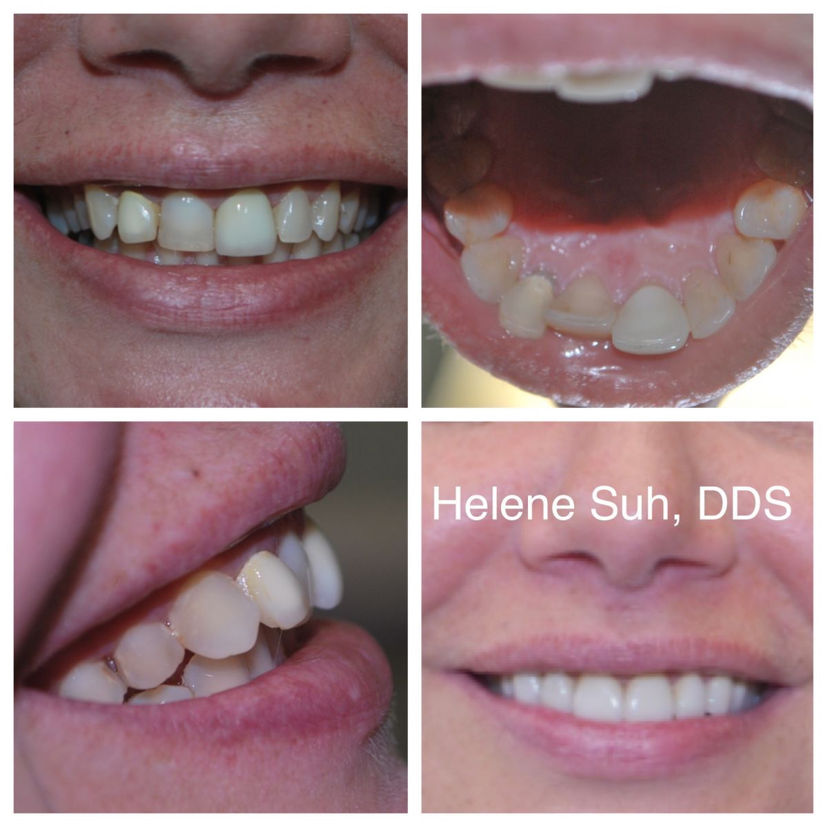 Beaumont Smile Center photo