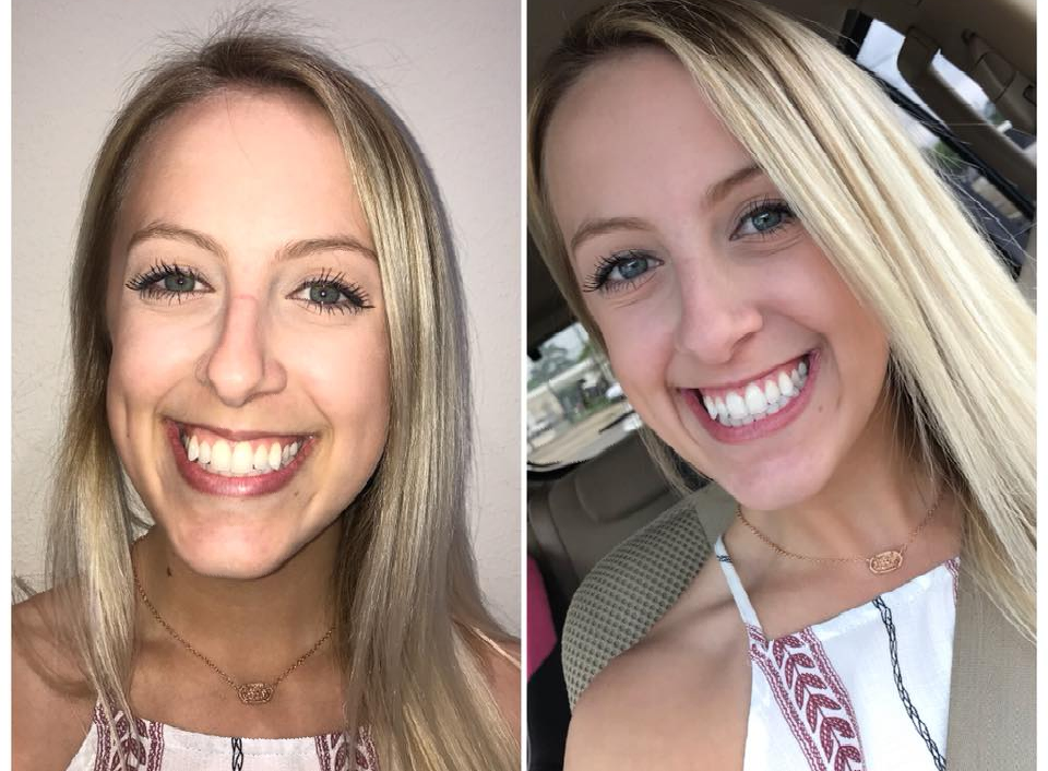 Cosmetic Dental Care