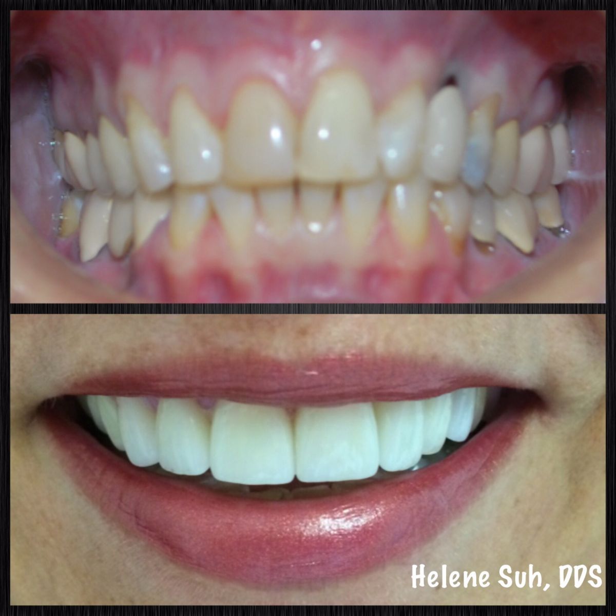 Beaumont Smile Center photo