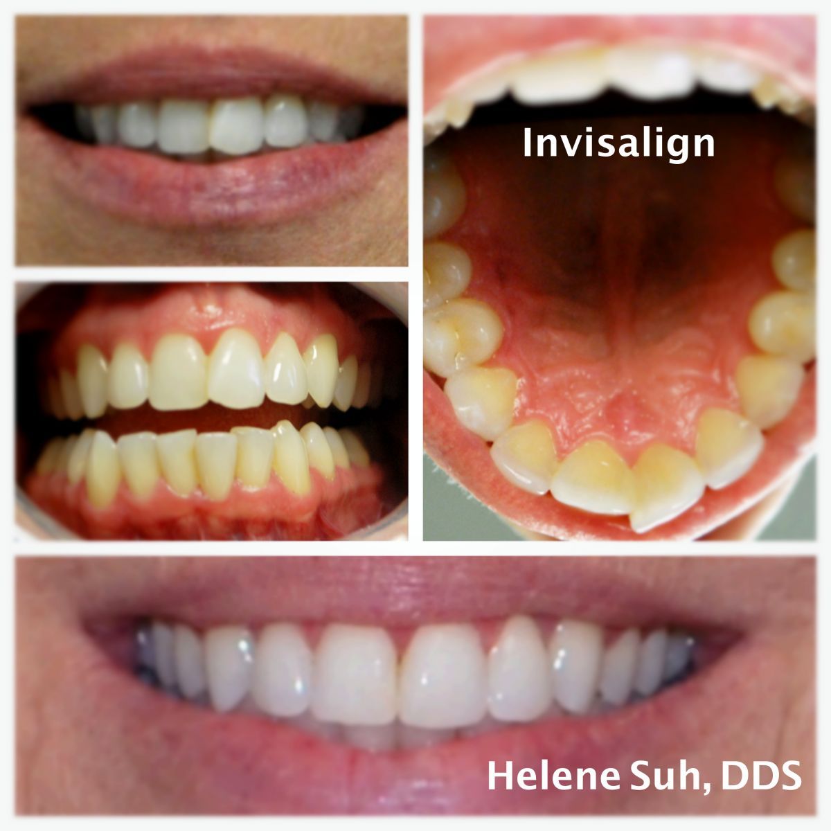 Beaumont Smile Center photo