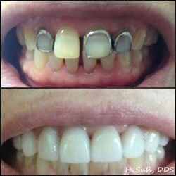 Beaumont Smile Center photo