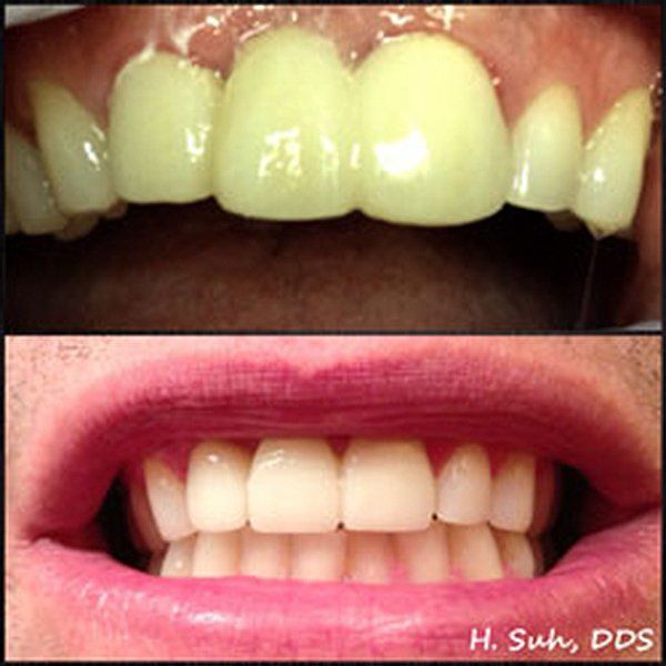 Beaumont Smile Center photo