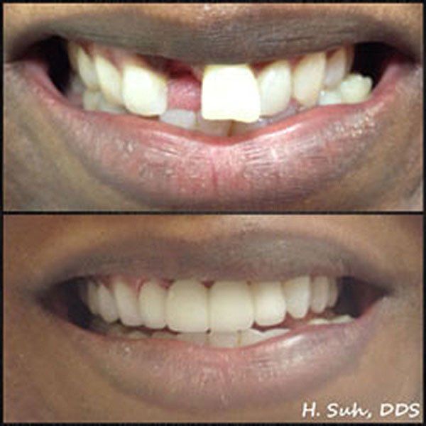 Beaumont Smile Center photo